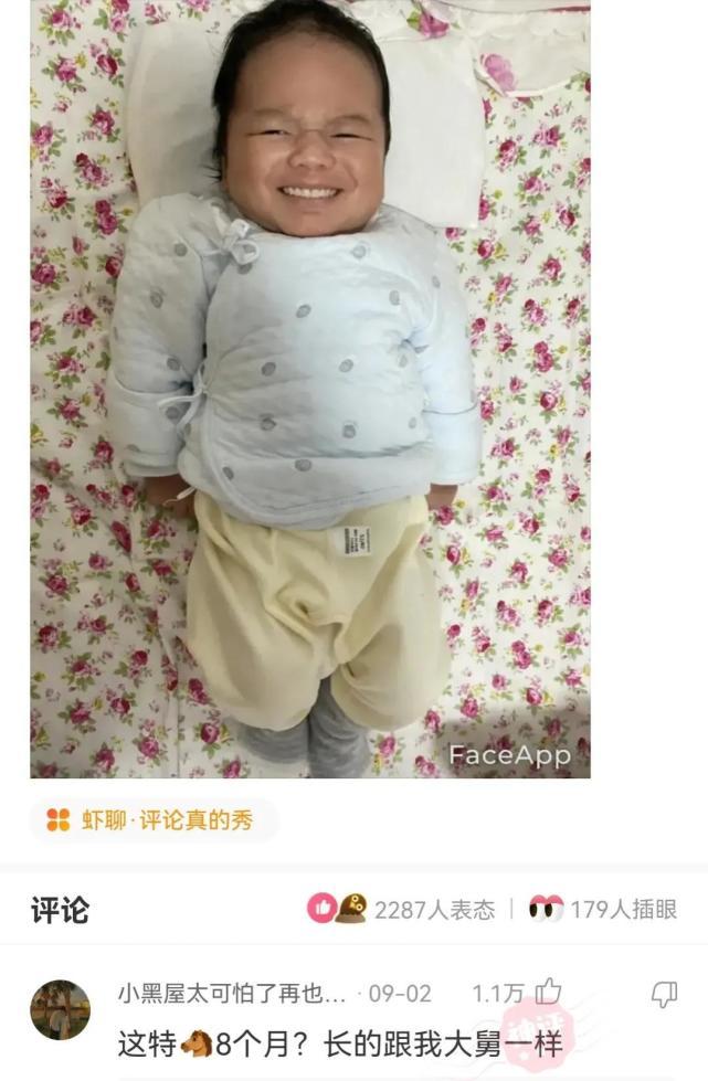 神回复:医院医生叫我不要用力,老中医叫我多活动,我该听谁的? 神回复:医院医生叫我不要用力,老中医叫我多活动,我该听谁的?