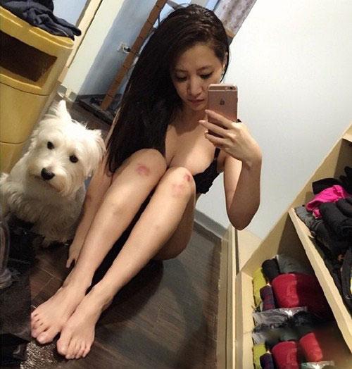 美女膝盖破了的图片 美女膝盖破了的图片