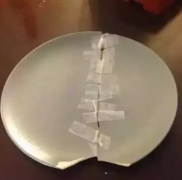 完美的修复技术。