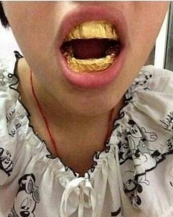 高富帅的满口金牙～