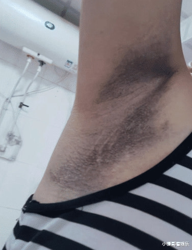 “网购了件衣服,没想到掉色这么严重!”哈哈哈你们自行体会! “网购了件衣服,没想到掉色这么严重!”哈哈哈你们自行体会!
