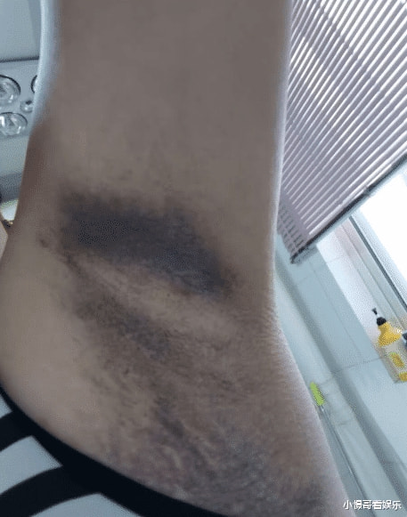 “网购了件衣服,没想到掉色这么严重!”哈哈哈你们自行体会! “网购了件衣服,没想到掉色这么严重!”哈哈哈你们自行体会!