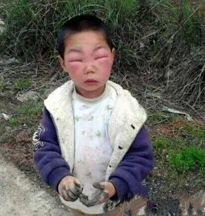 马蜂窝不能随便碰