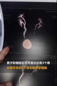 轻松一刻:色字头上一把刀,不怕自产怕自销! 轻松一刻:色字头上一把刀,不怕自产怕自销!