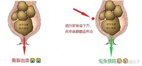 轻松一刻:色字头上一把刀,不怕自产怕自销! 轻松一刻:色字头上一把刀,不怕自产怕自销!