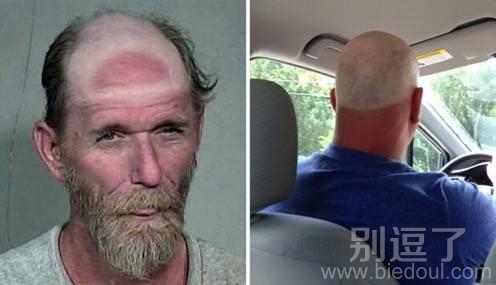 反戴帽子成这样了 反戴帽子成这样了