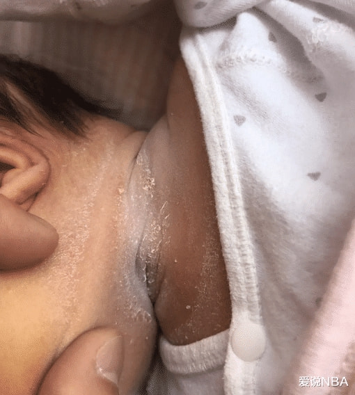“10天大的婴儿,这是怎么了?”哈哈哈哈洗一洗还可以要 “10天大的婴儿,这是怎么了?”哈哈哈哈洗一洗还可以要