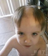 一个孩子的头发。 一个孩子的头发。