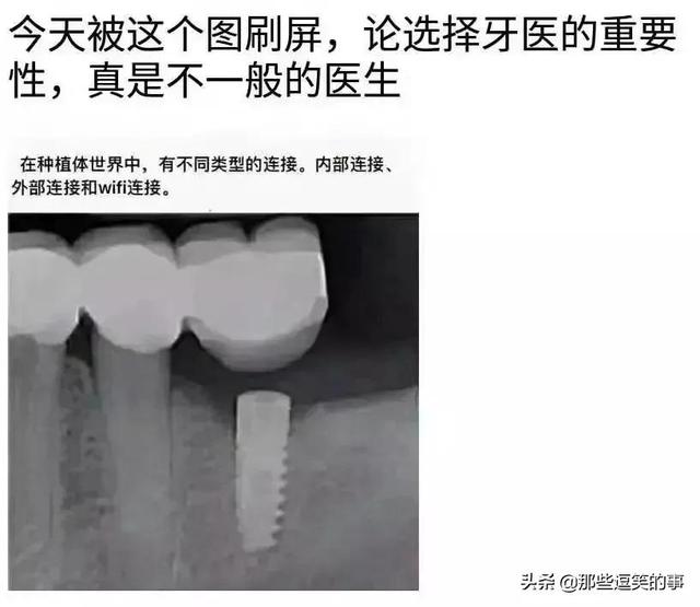 穿裙子的不一定是淑女,看看她们就知道了,自己也不觉得尴尬 穿裙子的不一定是淑女,看看她们就知道了,自己也不觉得尴尬
