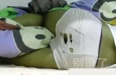 这是被仓鼠咬了吗