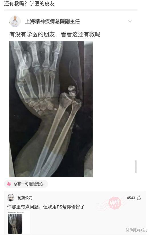 “钓鱼被咬了一口,谁知道这是什么咬的?”哈哈哈哈评论区却炸锅了! “钓鱼被咬了一口,谁知道这是什么咬的?”哈哈哈哈评论区却炸锅了!