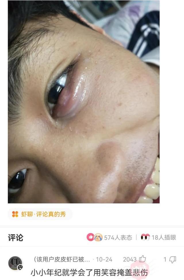 神回复:大脑不小心进水了,该怎么办? 神回复:大脑不小心进水了,该怎么办?