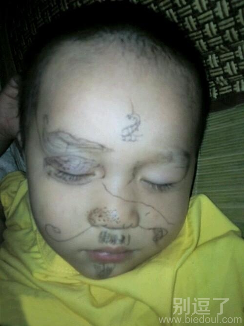 一个中招的小孩子。 一个中招的小孩子。