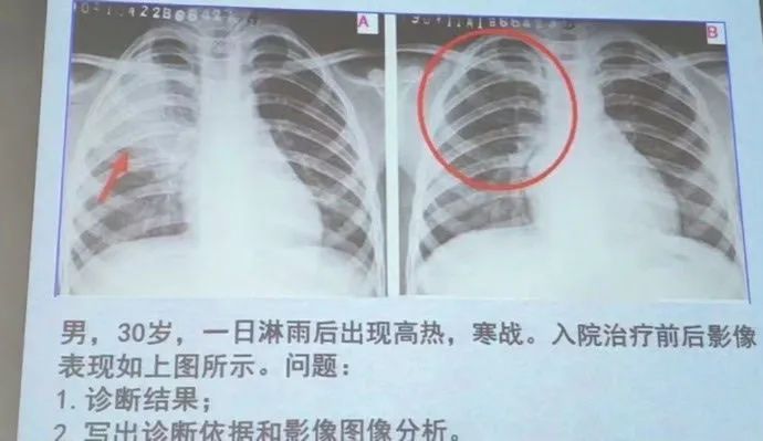 “医学生为了答题能有多努力??”哈哈哈哈给我笑不活了! “医学生为了答题能有多努力??”哈哈哈哈给我笑不活了!