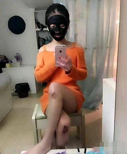 这膝盖的伤是哪里来的 这膝盖的伤是哪里来的