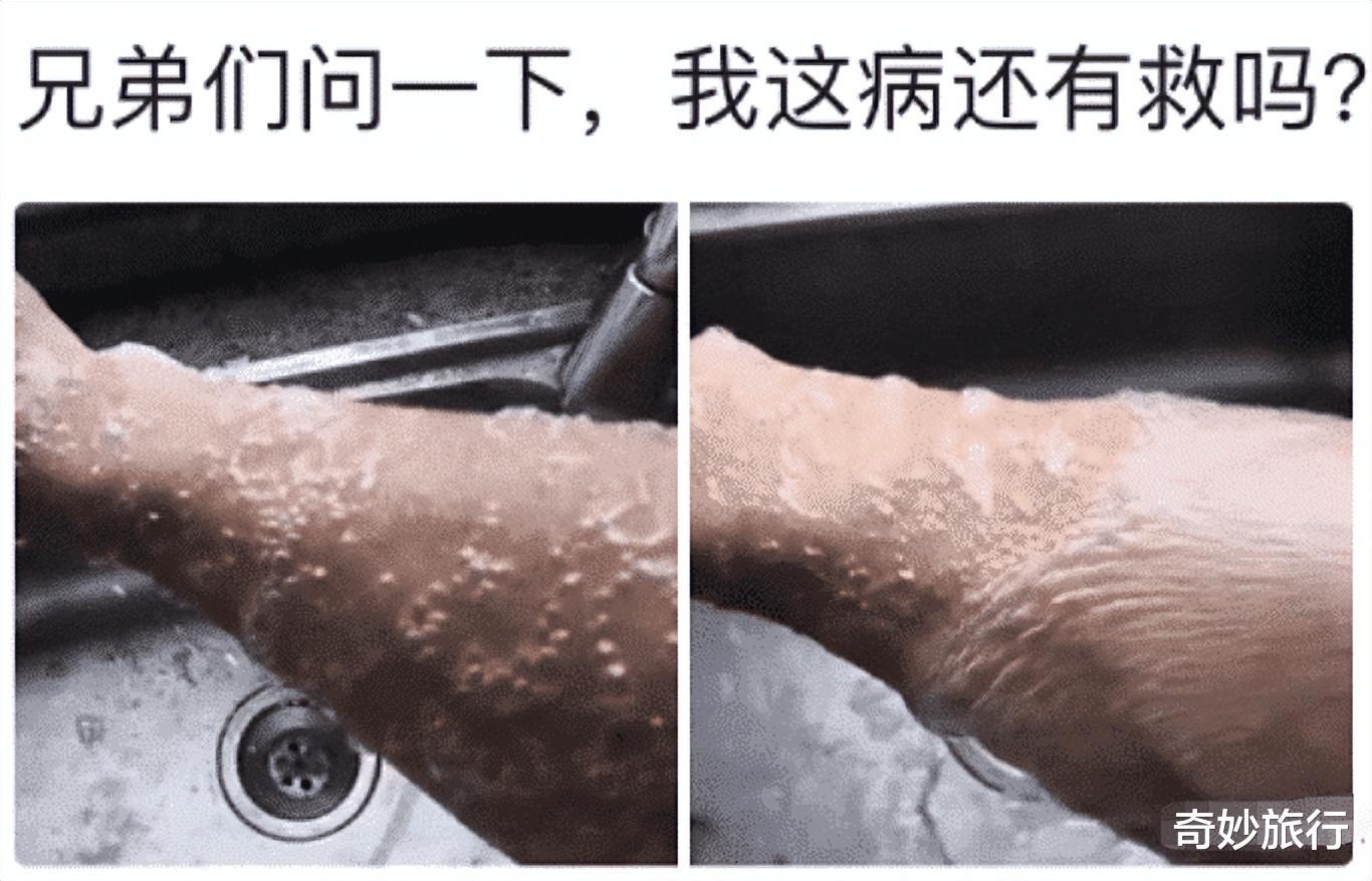“一沾水就犯病!!我这是怎么了?”建议卸掉~ “一沾水就犯病!!我这是怎么了?”建议卸掉~