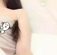 从未见过的毛发旺盛 从未见过的毛发旺盛