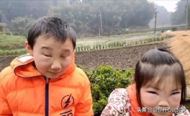 妹妹吵着跟哥哥上山掏马蜂窝,俩人回家就成这样了,这该怎么办? 妹妹吵着跟哥哥上山掏马蜂窝,俩人回家就成这样了,这该怎么办?