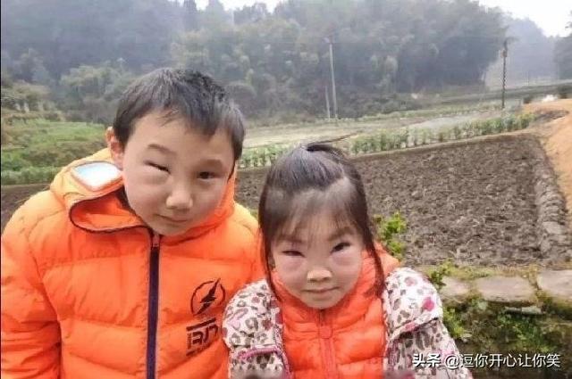 妹妹吵着跟哥哥上山掏马蜂窝,俩人回家就成这样了,这该怎么办? 妹妹吵着跟哥哥上山掏马蜂窝,俩人回家就成这样了,这该怎么办?