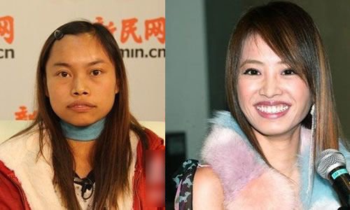 凤姐整容后照片--让你耳目一新