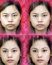 凤姐整容后照片--让你耳目一新