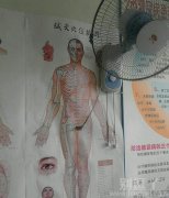 插在人体上的电风扇。