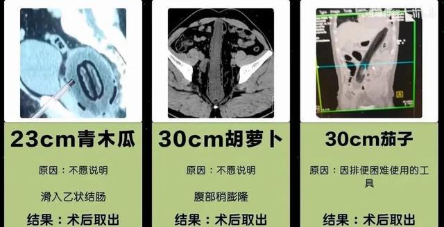 朋友圈收到阴阳怪气骚扰回复，淦！差点拳头硬了