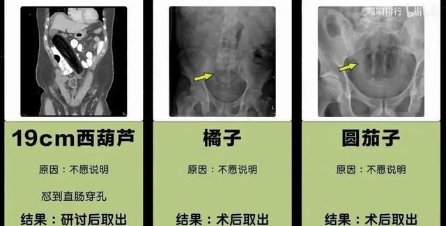 朋友圈收到阴阳怪气骚扰回复,淦!差点拳头硬了 朋友圈收到阴阳怪气骚扰回复,淦!差点拳头硬了