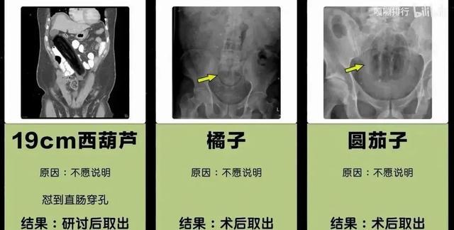 朋友圈收到阴阳怪气骚扰回复，淦！差点拳头硬了