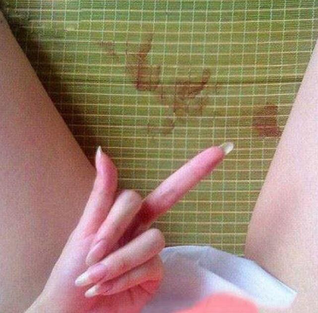 女友发来照片，还说是闺蜜拍的，后背上的方向盘痕迹是什么鬼？