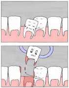 秀恩爱死的快 秀恩爱死的快