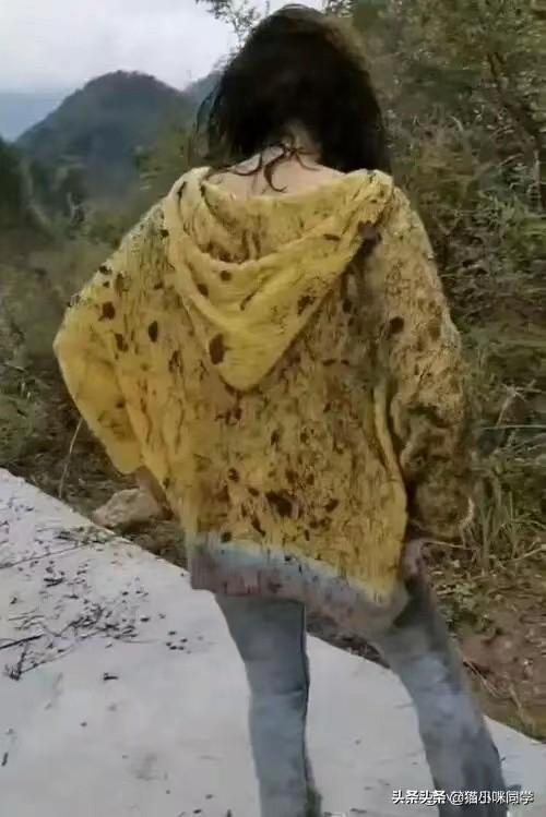 “跟同学一起爬山,结果摔成这样了,怎么跟老公解释?”哈哈哈 “跟同学一起爬山,结果摔成这样了,怎么跟老公解释?”哈哈哈