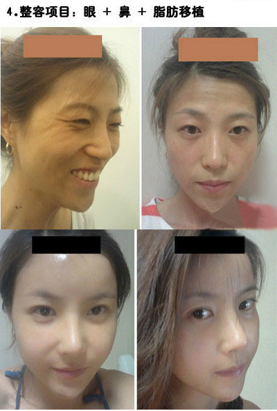 整容整出来的美女胚子。