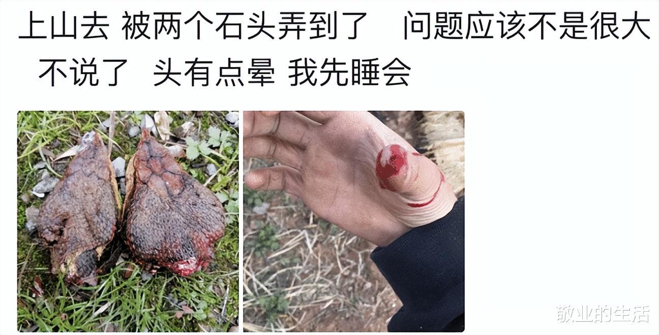 “在郊外山上,被两块石头碰到了,问题应该不大,”抬走吧~ “在郊外山上,被两块石头碰到了,问题应该不大,”抬走吧~