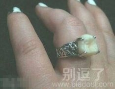 求婚戒指上是男友的智齿