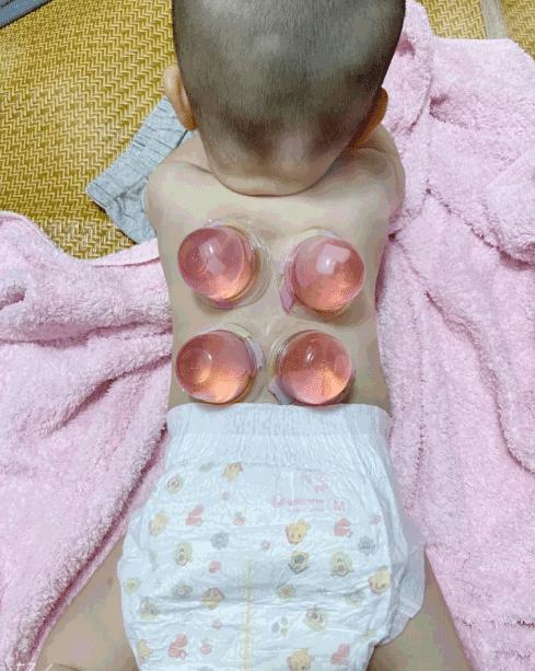 “生孩子如果不玩那将毫无意义,拔了个草莓味的火罐?”哈哈哈哈哈太可爱了 “生孩子如果不玩那将毫无意义,拔了个草莓味的火罐?”哈哈哈哈哈太可爱了