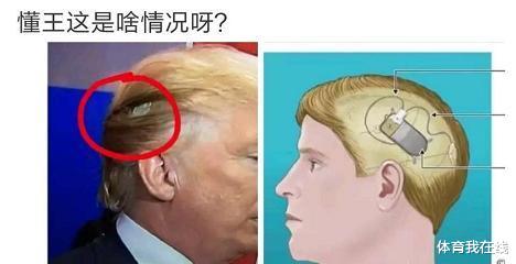 “懂王的头上这是啥情况？”王牌特工？哈哈哈哈