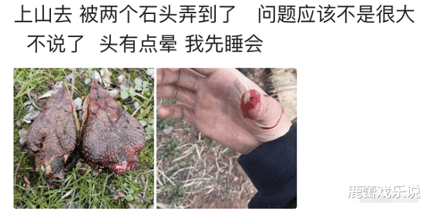 “只是被两块石头碰流血了,为啥头这么晕?”哈哈哈哈...哥们下辈子见! “只是被两块石头碰流血了,为啥头这么晕?”哈哈哈哈...哥们下辈子见!