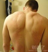 伤痕是男人的勋章！