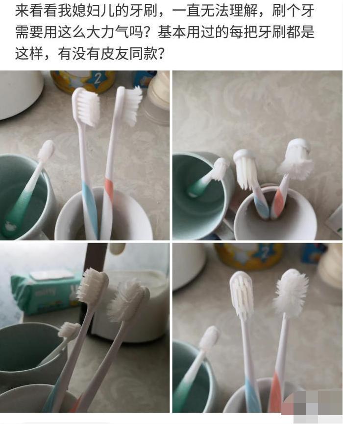 “献血之后,手腕就变成这样了!有人知道是啥情况吗?太吓人了!” “献血之后,手腕就变成这样了!有人知道是啥情况吗?太吓人了!”