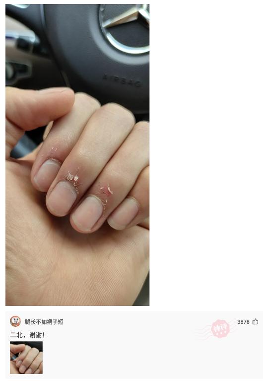老婆发来一张吃饭的照片,我看完后选择离婚,网友:这波太细心了 老婆发来一张吃饭的照片,我看完后选择离婚,网友:这波太细心了