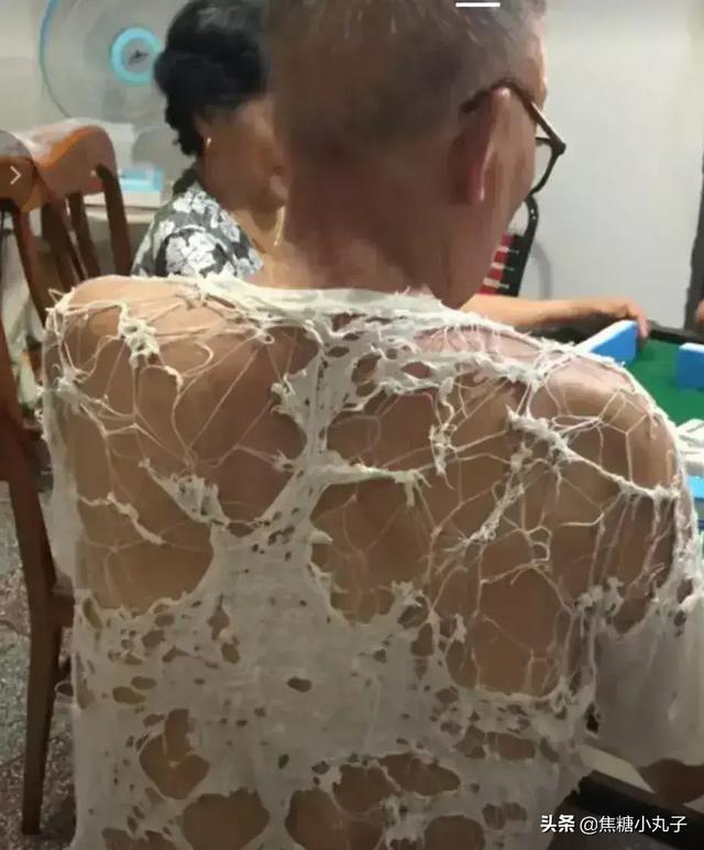 昨天晚上和男朋友去了一次宾馆,今天就这样了,还很痒,还有救吗 昨天晚上和男朋友去了一次宾馆,今天就这样了,还很痒,还有救吗
