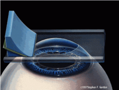 关于手术的那些事儿 关于手术的那些事儿