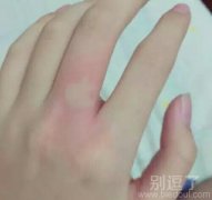 现在蚊子都这么势力