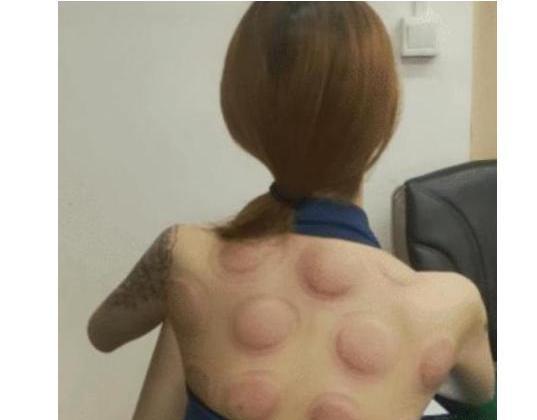老婆跟着老板出差,回来后身上就成这个样子了,我是被绿了吗? 老婆跟着老板出差,回来后身上就成这个样子了,我是被绿了吗?
