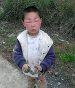 恐怕你妈都不认识你了吧
