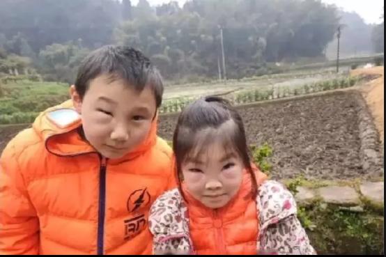 要被熊孩子们气死了,哥哥带妹妹去掏马蜂窝,结果两人变成这样了 要被熊孩子们气死了,哥哥带妹妹去掏马蜂窝,结果两人变成这样了