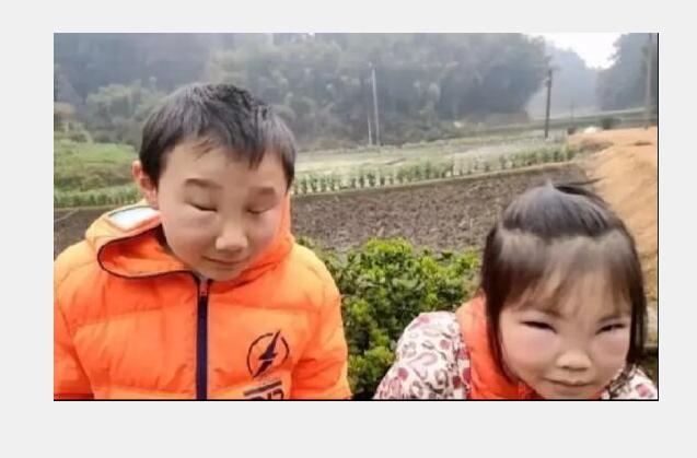 要被熊孩子们气死了,哥哥带妹妹去掏马蜂窝,结果两人变成这样了 要被熊孩子们气死了,哥哥带妹妹去掏马蜂窝,结果两人变成这样了