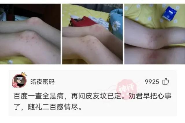 神回复:手掌被老婆坐了一屁股,我还有救吗?求帮助!哈哈哈哈 神回复:手掌被老婆坐了一屁股,我还有救吗?求帮助!哈哈哈哈