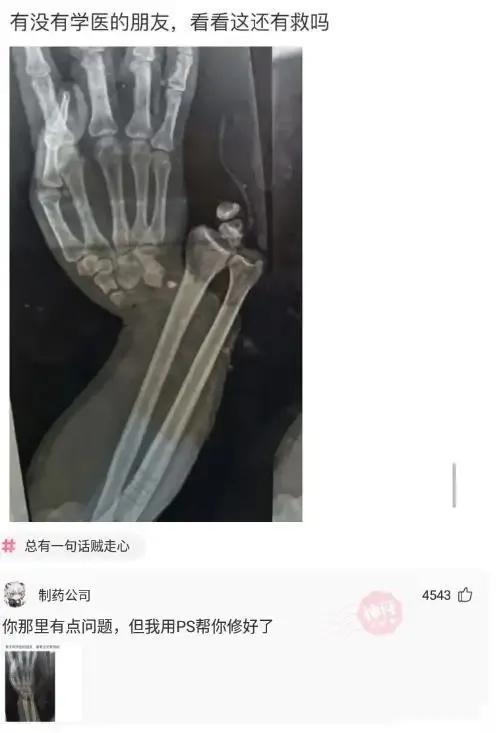 神回复:手掌被老婆坐了一屁股,我还有救吗?求帮助!哈哈哈哈 神回复:手掌被老婆坐了一屁股,我还有救吗?求帮助!哈哈哈哈
